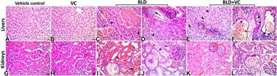 Boldenone Undecylenate-Mediated Hepatorenal Impairment by Oxidative Damage and Dysregulation of Heat Shock Protein 90 and Androgen Receptors Expressions: Vitamin C Preventive Role